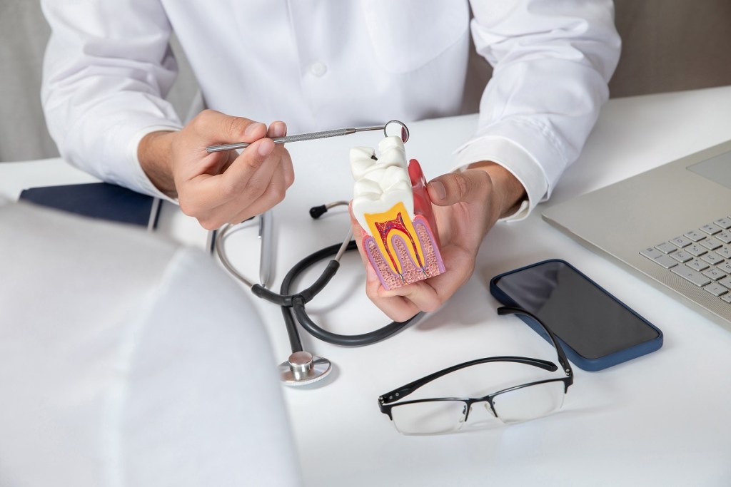 Frequently Asked Questions About Root Canal Therapy