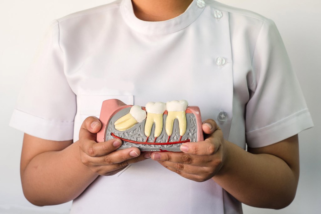What Happens When Wisdom Teeth Are Impacted?