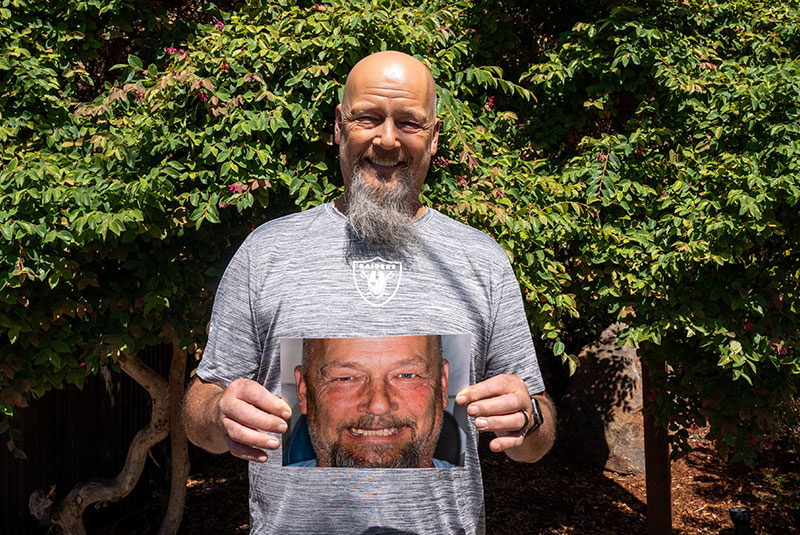Patient Holding up before and after photo of their teeth